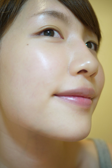 光纖粉餅雷射淡斑美白改善膚質