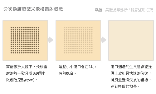 鉺雅各汽化雷射 除凸痣 除肉芽 美麗晶華診所