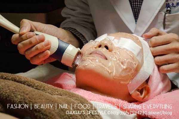 光纖粉餅雷射臉部治療過程