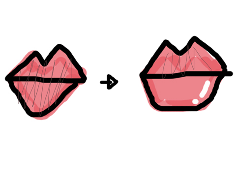 玻尿酸豐唇示意圖